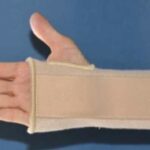 סד יד צו צדדי אסא | ASSA Wrist Splint - S-M